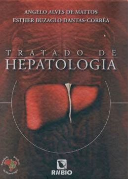 Imagem de TRATADO DE HEPATOLOGIA 
