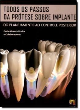 Imagem de TODOS OS PASSOS DA PROTESE SOBRE IMPLANTE