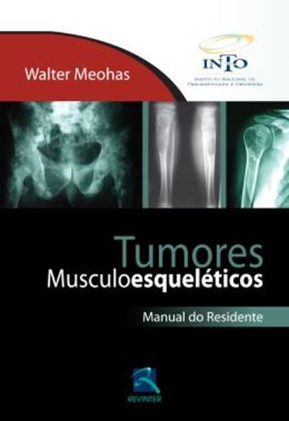 Picture of TUMORES MUSCULOESQUELETICOS - MAN. DO RESID.