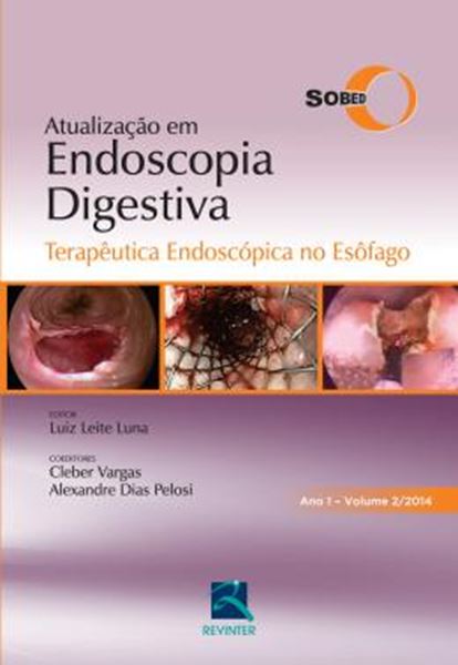 Picture of TERAP.ENDOSC. NO ESOFAGO - ANO 1  VOL. 2 - ATUALI. ENDOSC.DIGESTIVA