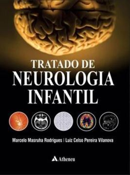 Imagem de TRATADO DE NEUROLOGIA INFANTIL