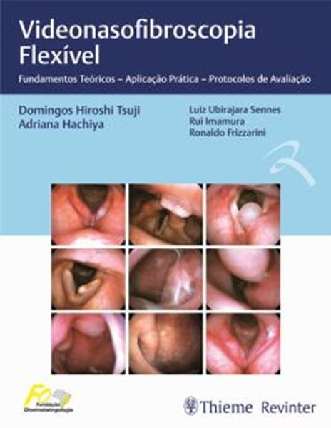 Picture of VIDEONASOLARINGOSCOPIA