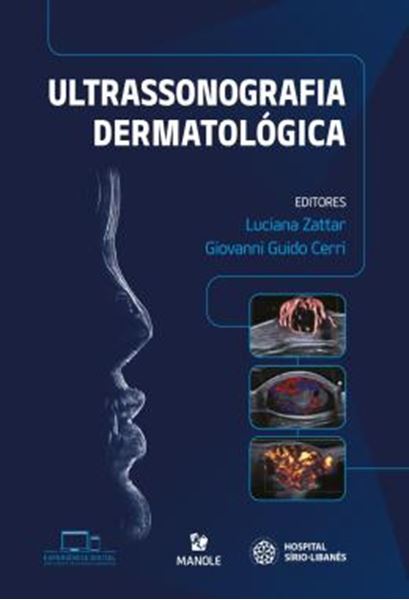 Picture of ULTRASSONOGRAFIA DERMATOLOGICA