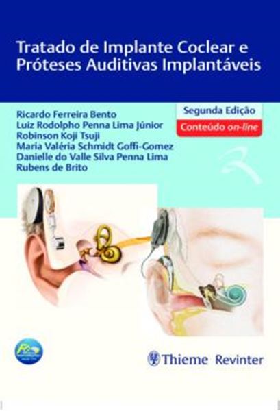 Picture of TRATADO DE IMPLANTE COCLEAR E PROTESES AUDITIVAS IMPLANTAVEIS - 2ª ED