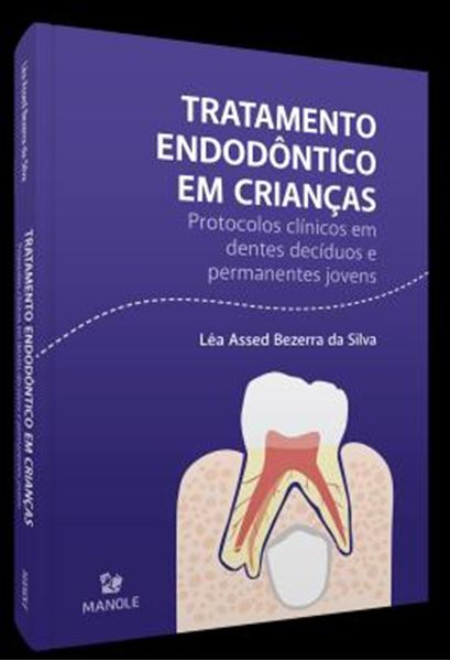Picture of TRATAMENTO ENDODONTICO EM CRIANCAS