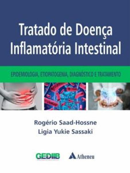 Picture of TRATADO DE DOENCA INFLAMATORIA INTESTINAL - EPIDEMIOLOGIA, ETIOPATOGENIA, DIAGNOSTICO E TRATAMENTO