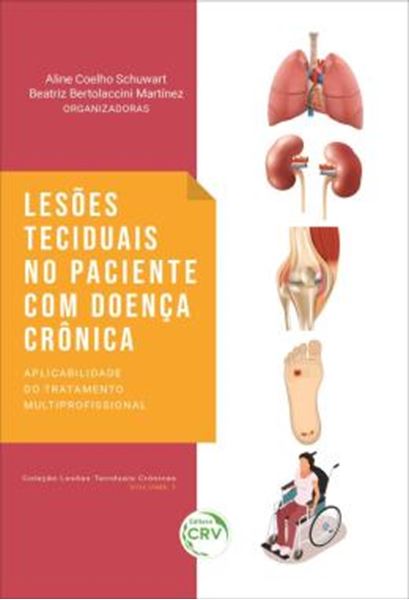 Picture of LESOES TECIDUAIS NO PACIENTE COM DOENCA CRONICA - APLICABILIDADE DO TRATAMENTO MULTIPROFISSIONAL