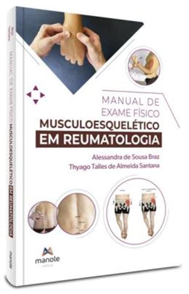 Picture of MANUAL DE EXAME FISICO MUSCULOESQUELETICO EM REUMATOLOGIA