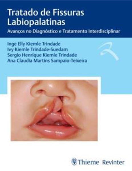 Picture of TRATADO DE FISSURAS LABIOPALATINAS