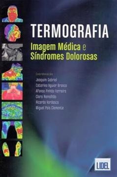 Imagem de TERMOGRAFIA. IMAGEM MEDICA E SINDROMES DOLOROSAS